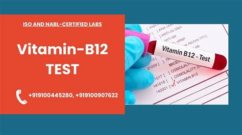 vitamin b12 lab test cost